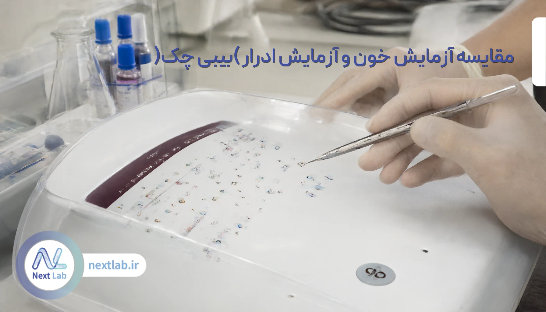 مقایسه آزمایش خون و آزمایش ادرار (بیبی چک)