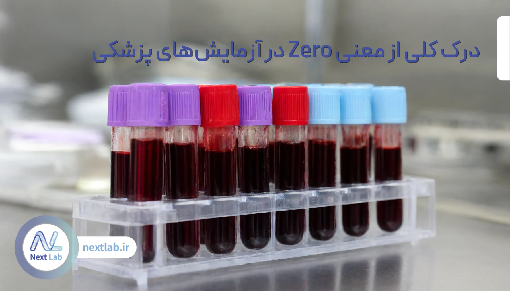 درک کلی از معنی Zero در آزمایشهای پزشکی